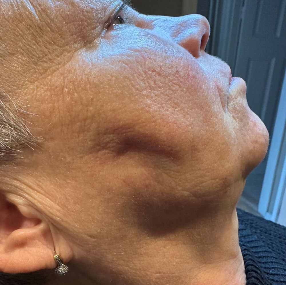 Bild före behandling